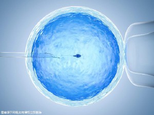 冷冻设备